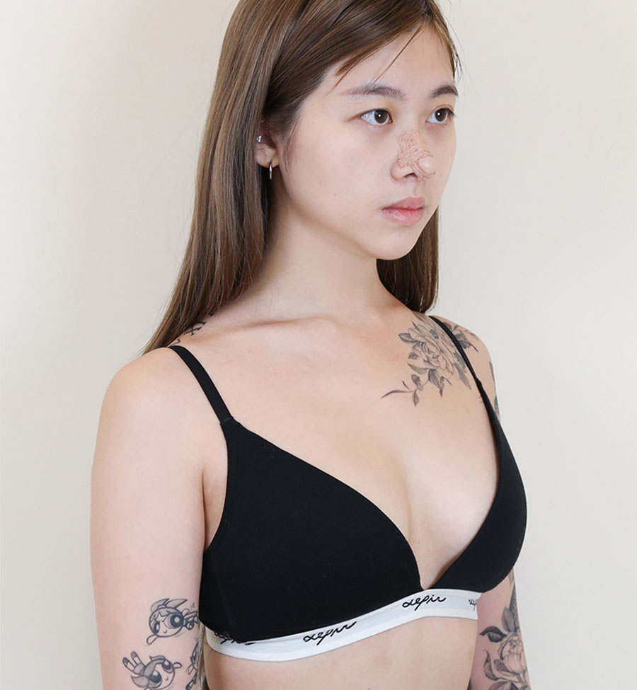 BF