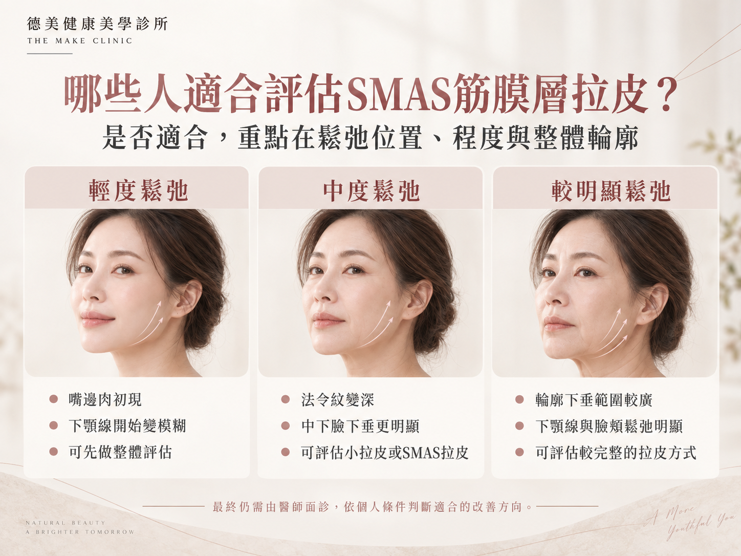 SMAS筋膜層拉皮適合族群,依輕度、中度與較明顯鬆弛程度比較