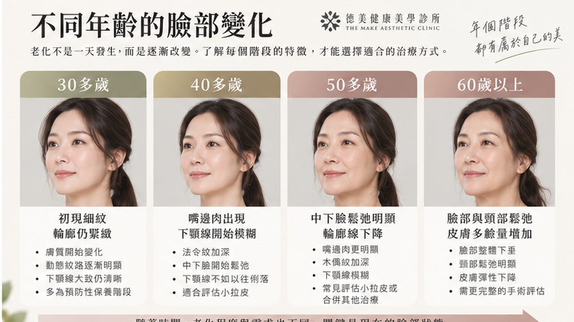 不同年齡常見臉部老化變化，包含30多歲、40歲、50歲與60歲以上