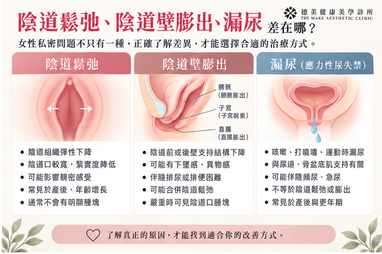 女性私密健康常見問題與骨盆底支撐差異圖