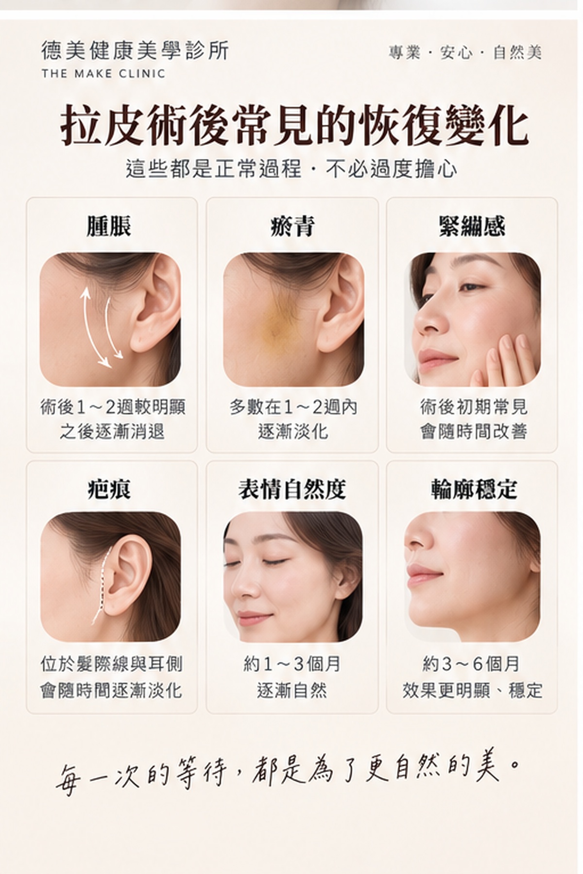 拉皮術後常見恢復變化,包括腫脹、瘀青、緊繃感、疤痕、表情自然度與輪廓穩定