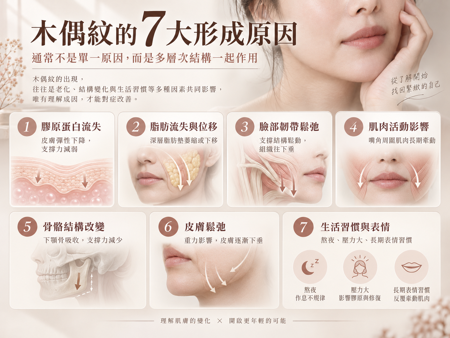 木偶紋七大形成原因:骨架、體積流失、肌肉拉力、皮膚鬆弛與組織下移